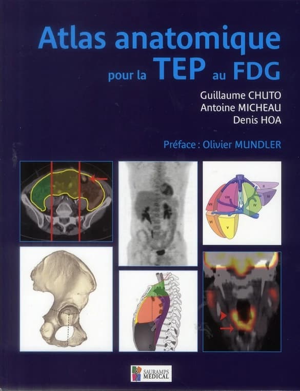 Atlas anatomique pour la TEP au FDG
