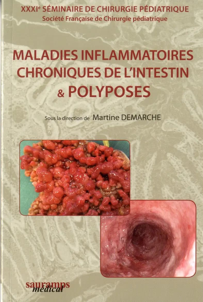 Maladies inflammatoires chroniques de l'intestin & polyposes : XXXIe Séminaire de chirurgie pédiatrique