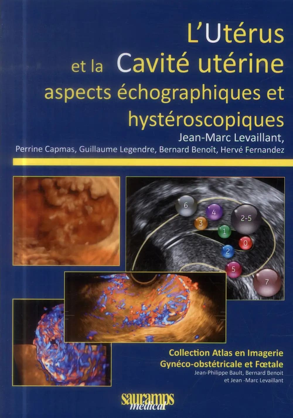 L'utérus et la cavité utérine : aspects échographiques et hystéroscopiques