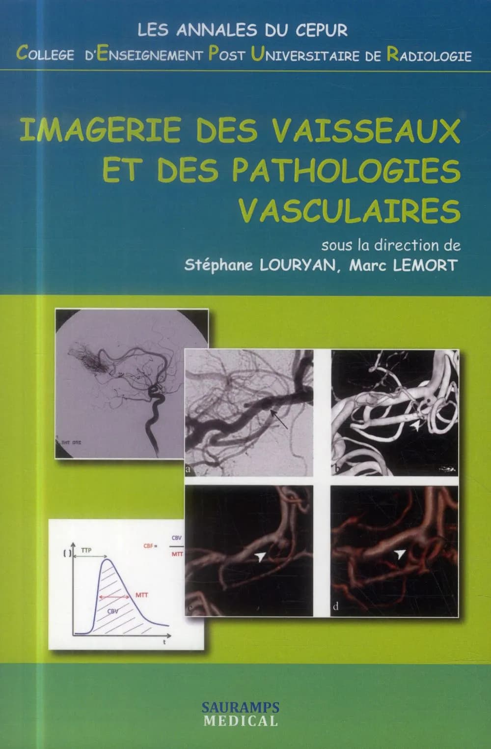 Imagerie des vaisseaux et des pathologies vasculaires