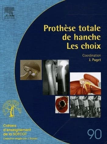 Prothèse totale de hanche : les choix
