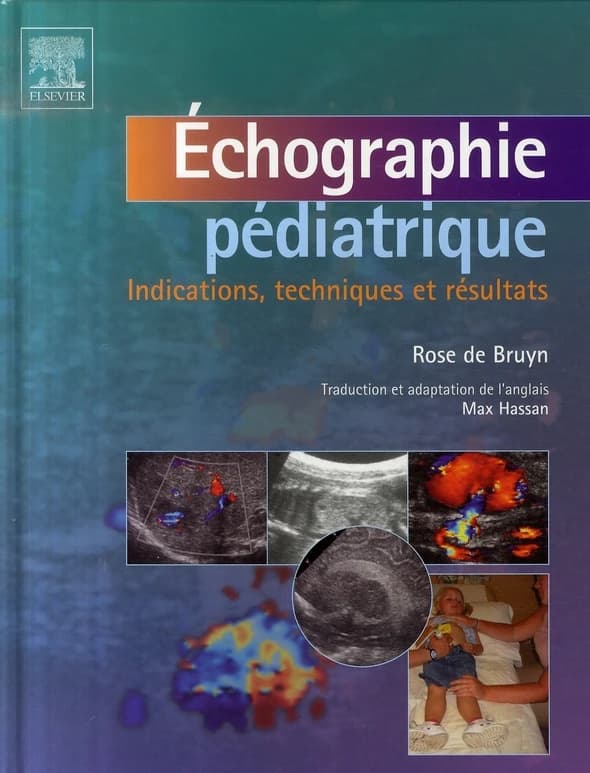Échographie pédiatrique : indications, techniques et résultats
