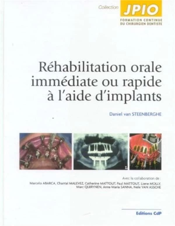 Réhabilitation orale immédiate ou rapide à l'aide d'implants