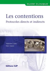 Les contentions : Protocoles cliniques directs et indirects