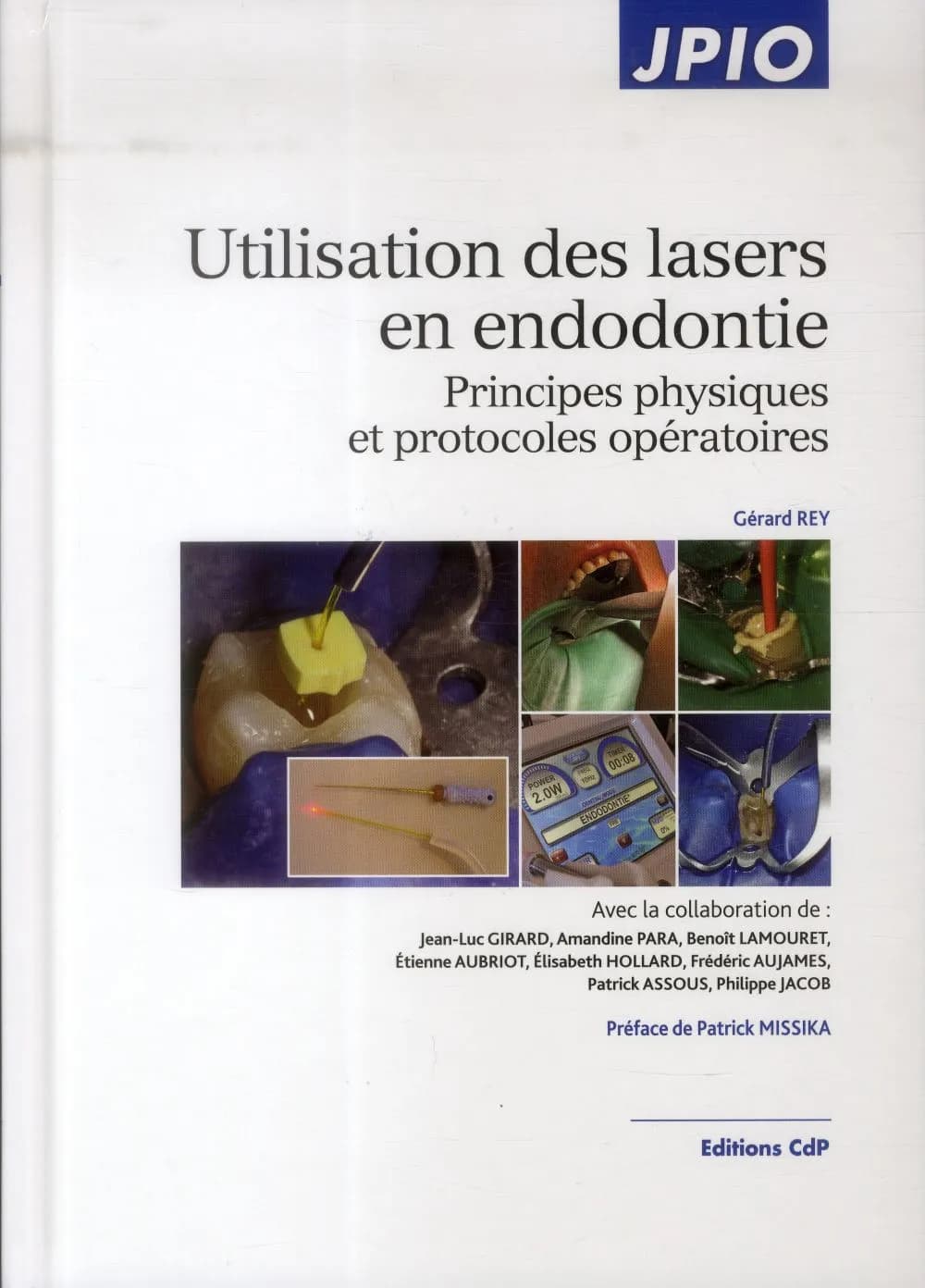 Utilisation des lasers en endodontie : principes physiques et protocoles opératoires