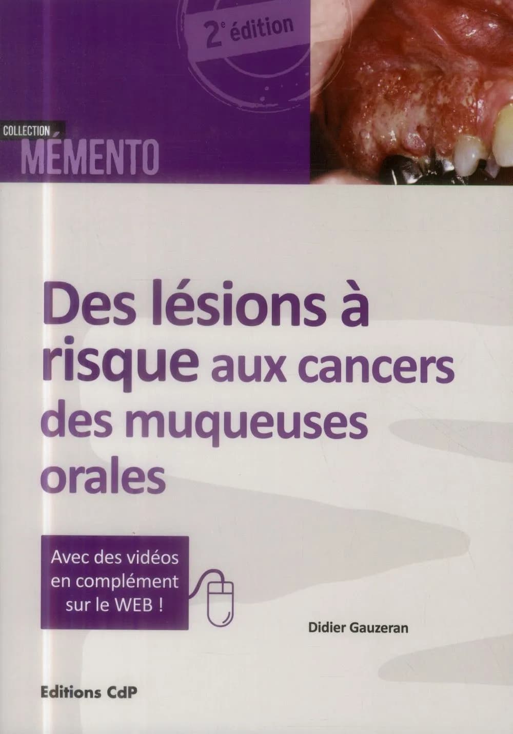 Des lésions à risque aux cancers des muqueuses orales (2e éd.) Didier Gauzeran,...