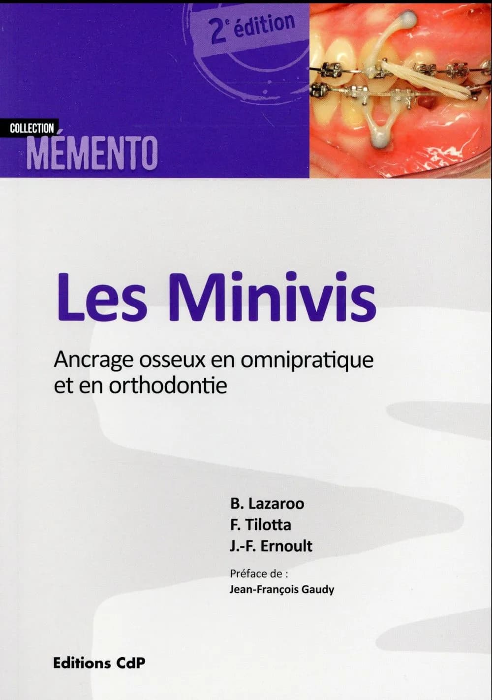 Les minivis : ancrage osseux en omnipratique et en orthodontie (2e éd.) Bernard Lazaroo,... Françoise Tilotta,... Jean-François Ernoult,...
