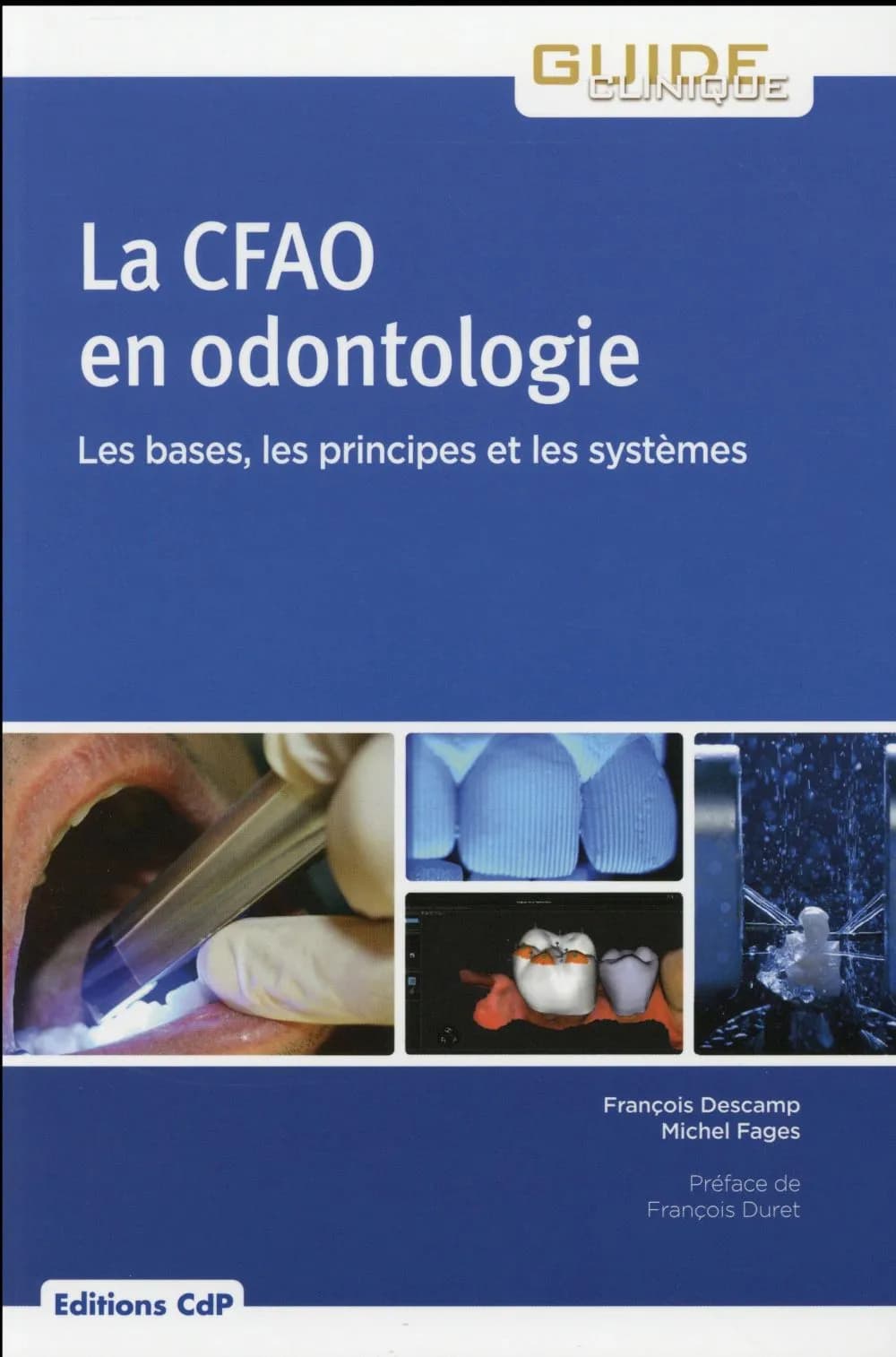 La CFAO en odontologie : les bases, les principes et les systèmes