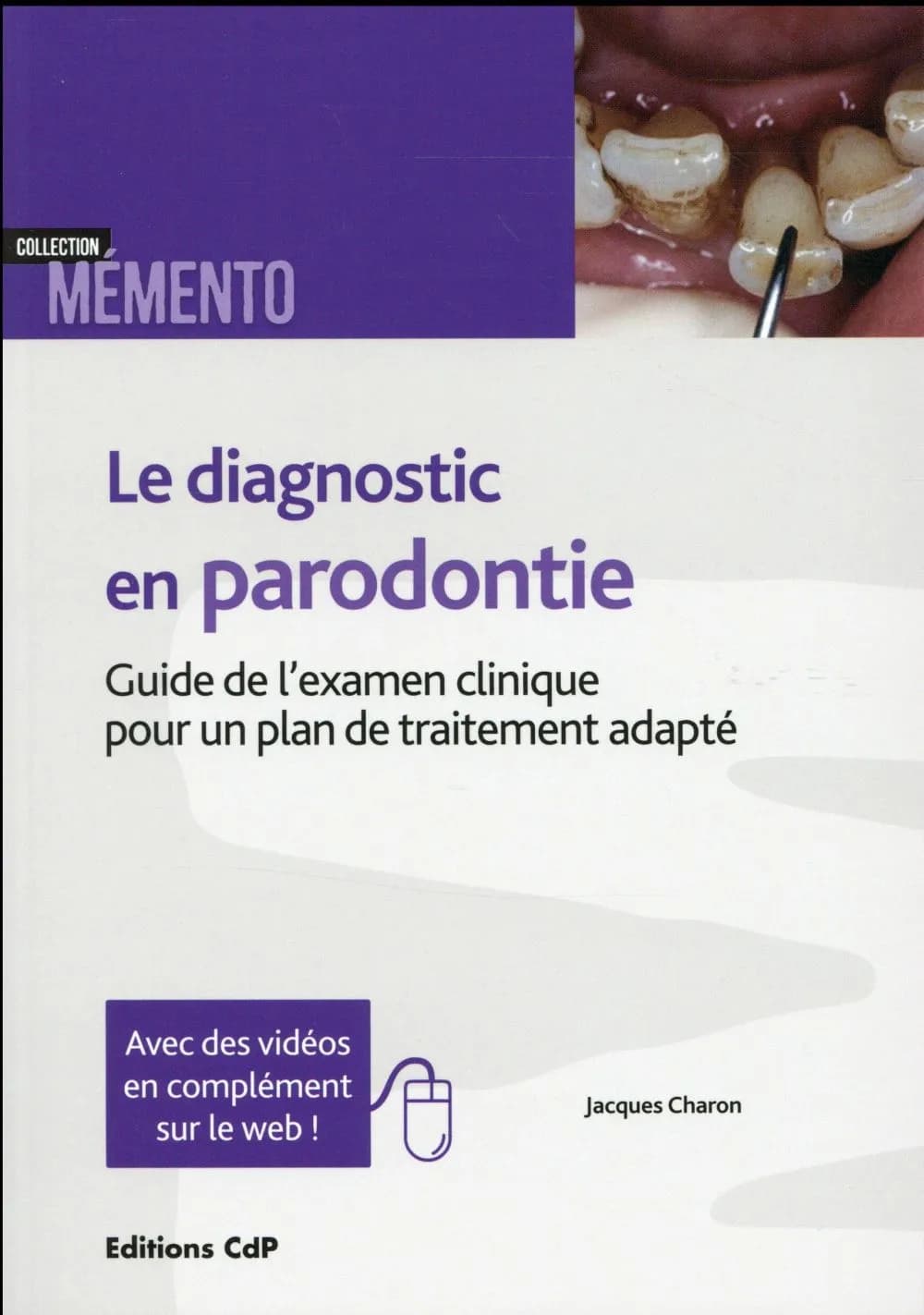 Le diagnostic en parodontie : guide de l'examen clinique pour un plan de traitement adapté