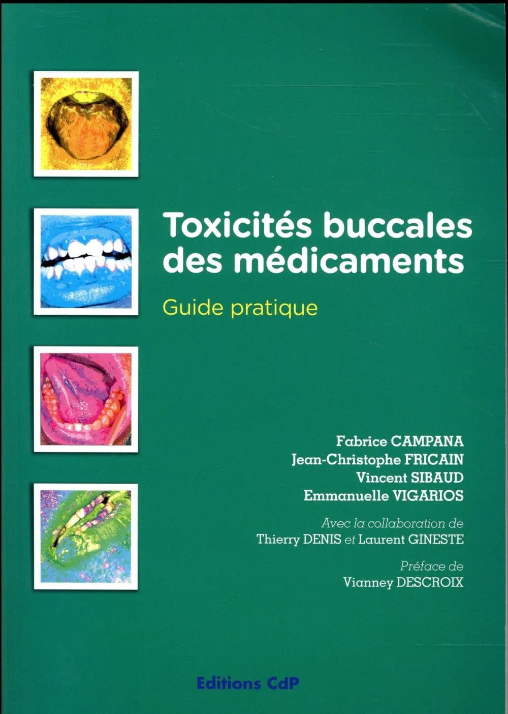 Toxicités buccales des médicaments : guide pratique