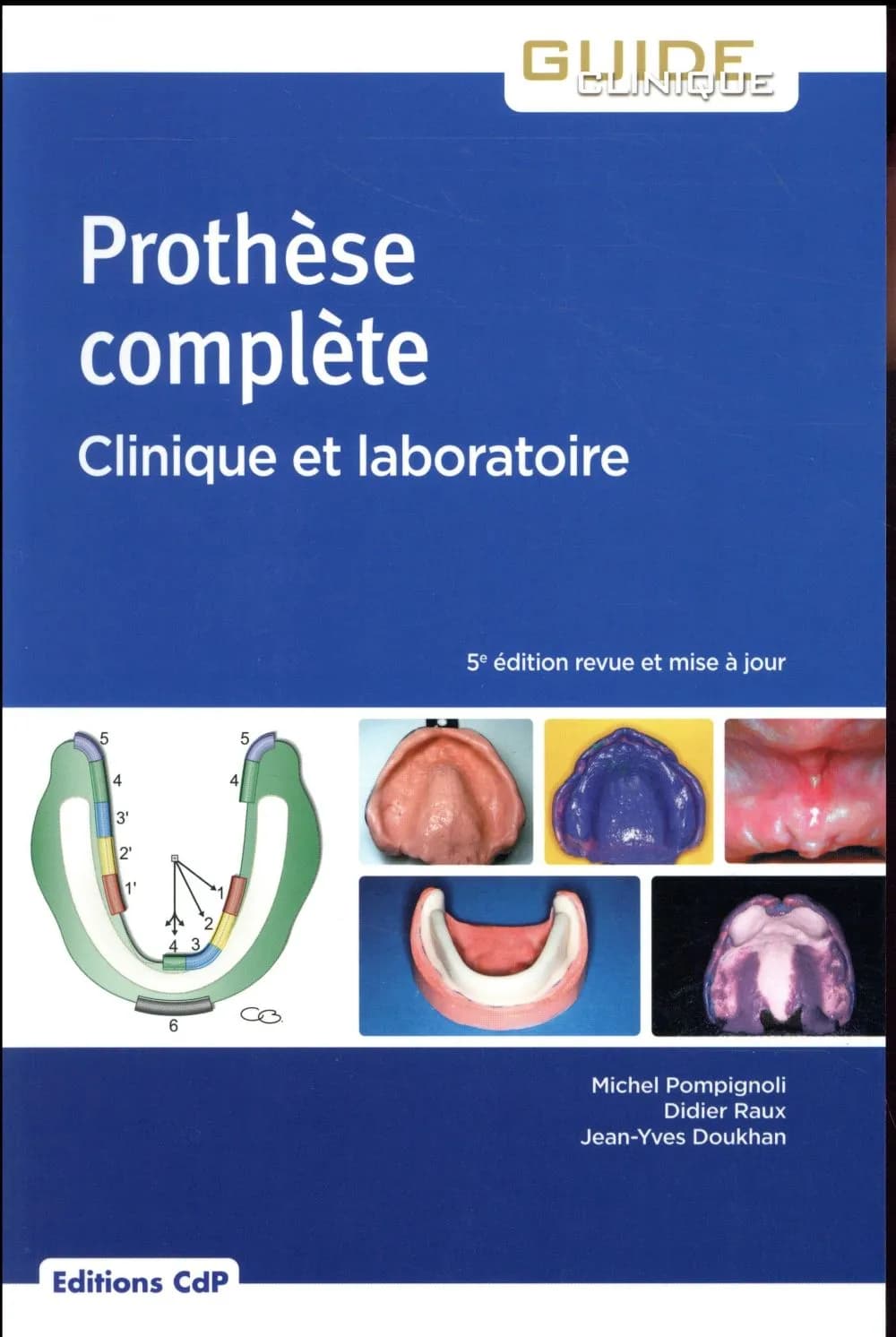 Prothèse complète : clinique et laboratoire (5e éd. [revue et mise à jour]) Michel Pompignoli,...Didier Raux,... Jean-Yves Doukhan,... ; ouvrage dirigé par le docteur Alain Irsa