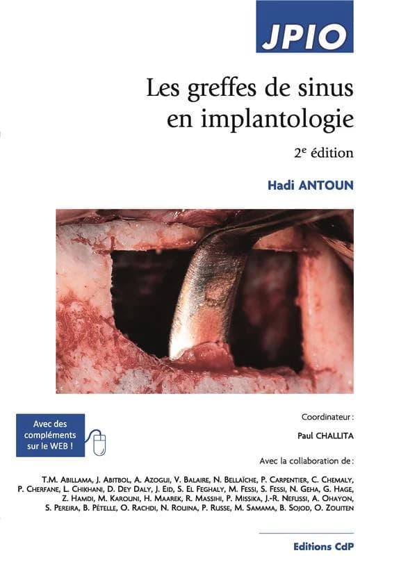 Les greffes de sinus en implantologie (2e éd.) Hadi Antoun ; coordinateur, Paul Challita ; avec la collaboration de Theodore Majid Abillama, Jérémy Abitbol, Axel Azogui... [et al.]