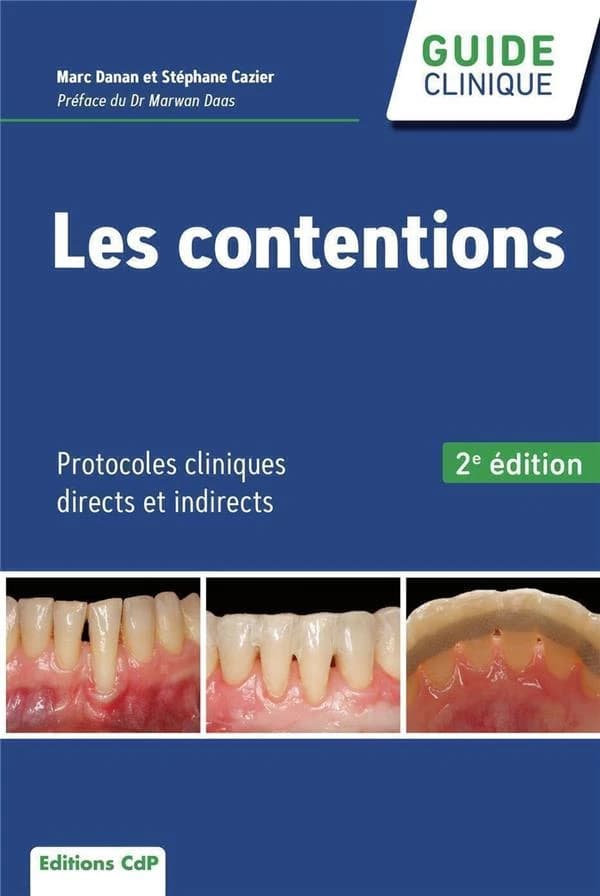 Les contentions : protocoles cliniques directs et indirects (2e éd.) Marc Danan,... Stéphane Cazier,...