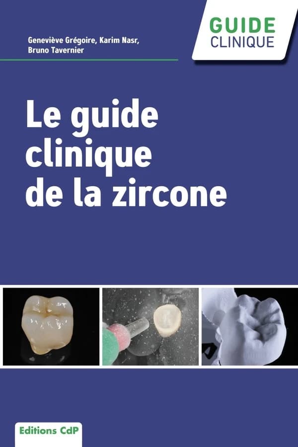 Guide clinique de la zircone