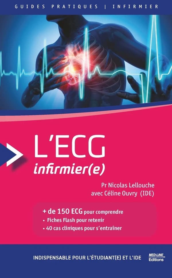 L'ECG infirmier(e)