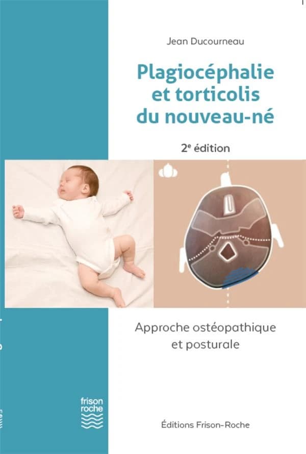 Plagiocéphalie et torticolis du nouveau-né : approche ostéopathique et posturale (2e éd.) Jean Ducourneau,...