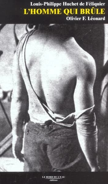 L'homme qui brûle