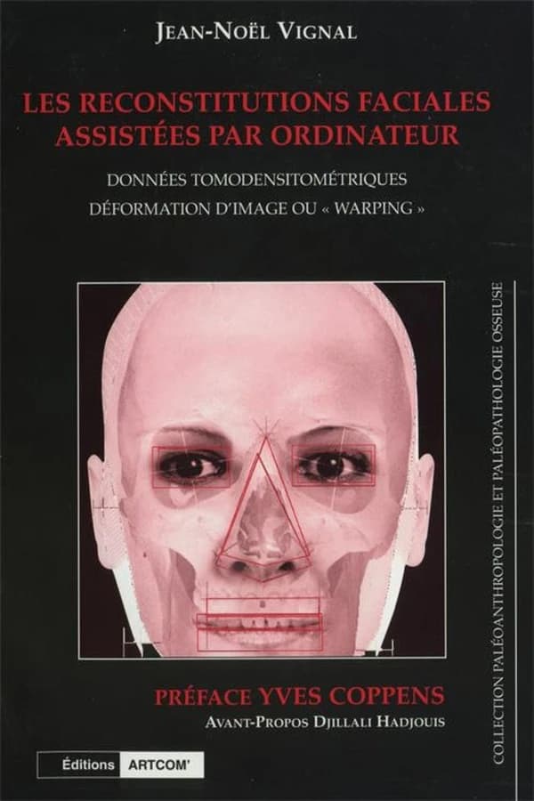 Les reconstitutions faciales assistées par ordinateur : données tomodensitométriques, déformation d'image ou warping