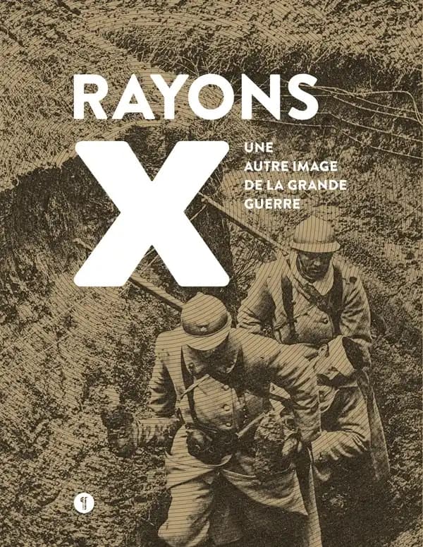 Rayons X : une autre image de la Grande guerre