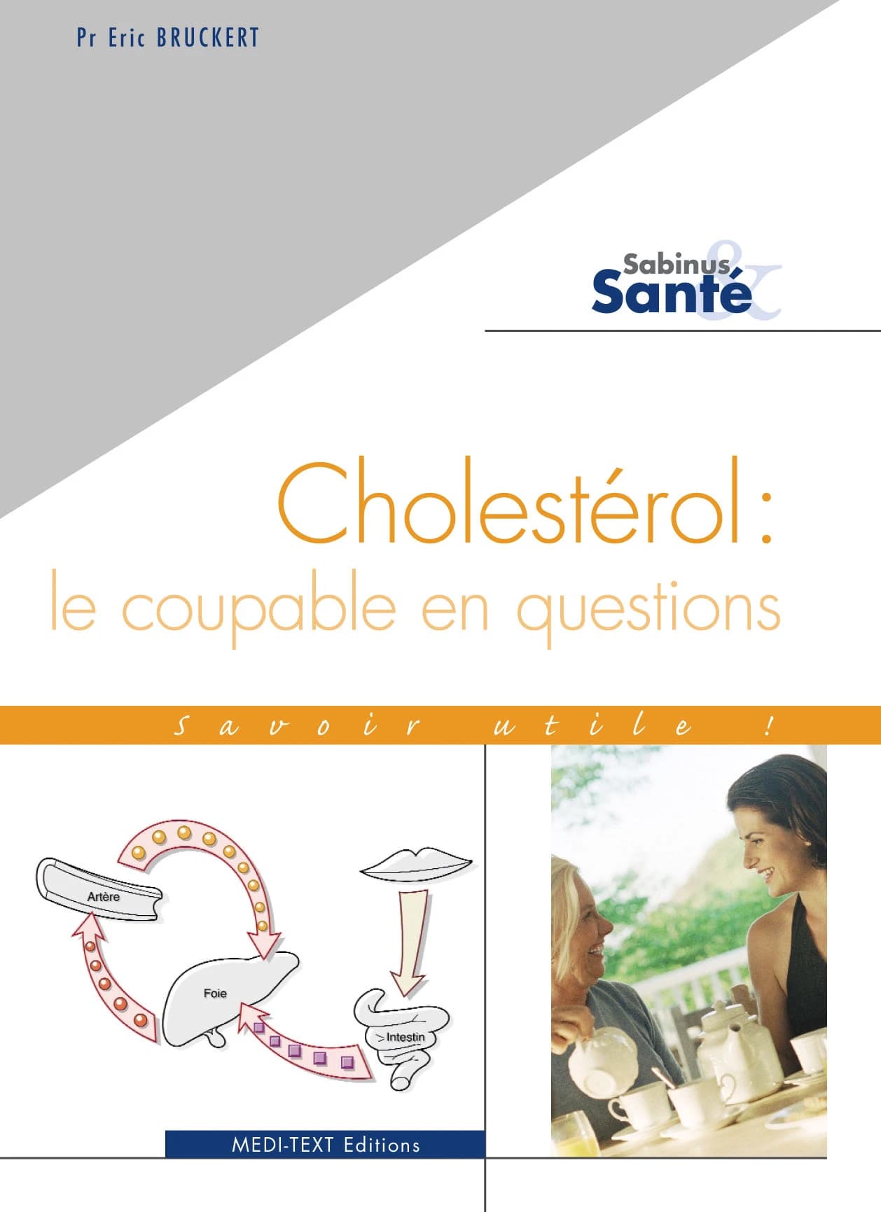 Cholestérol : le coupable en questions