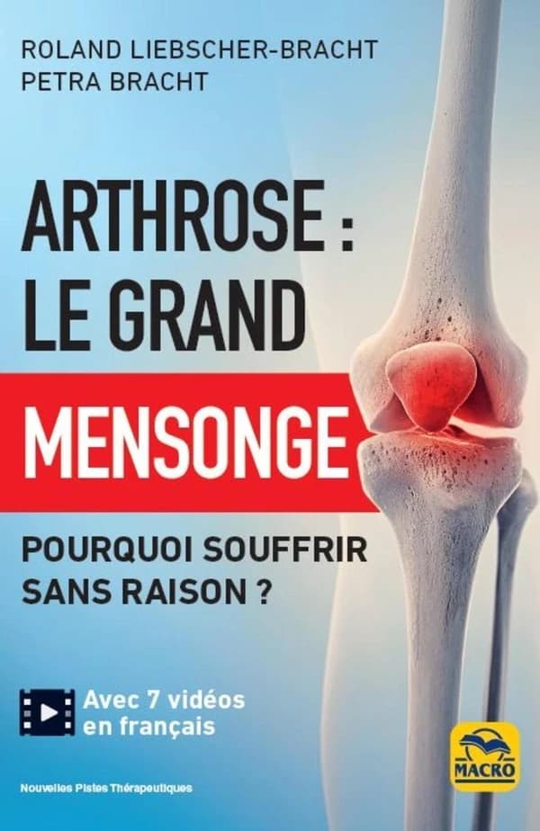 Arthrose : le grand mensonge ; pourquoi souffrir sans raison ?