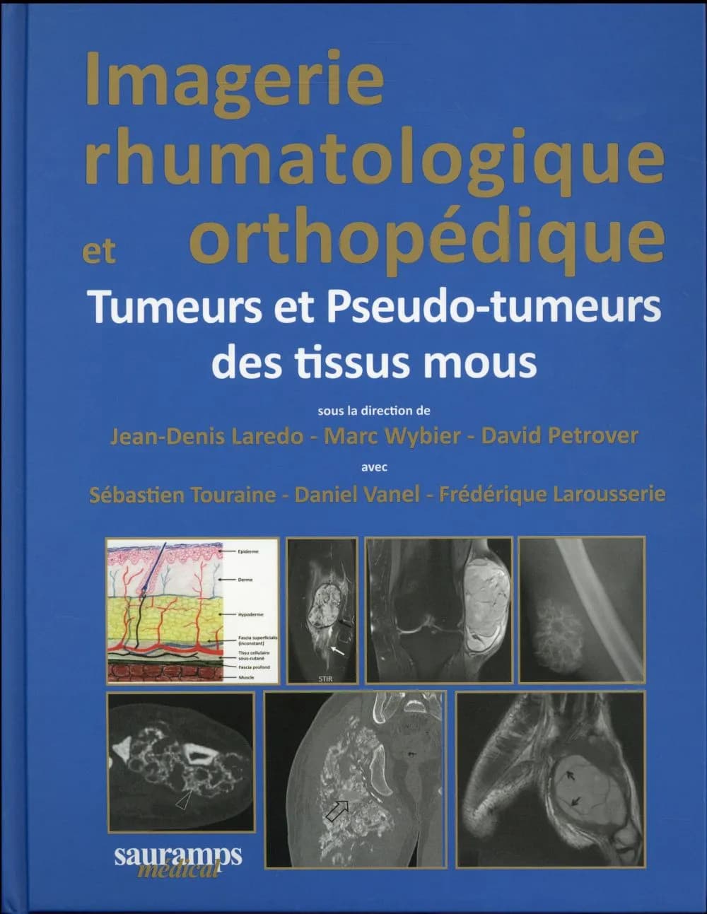 Imagerie rhumatologique et orthopédique. [Tome 5], Tumeurs et pseudo-tumeurs des tissus mous