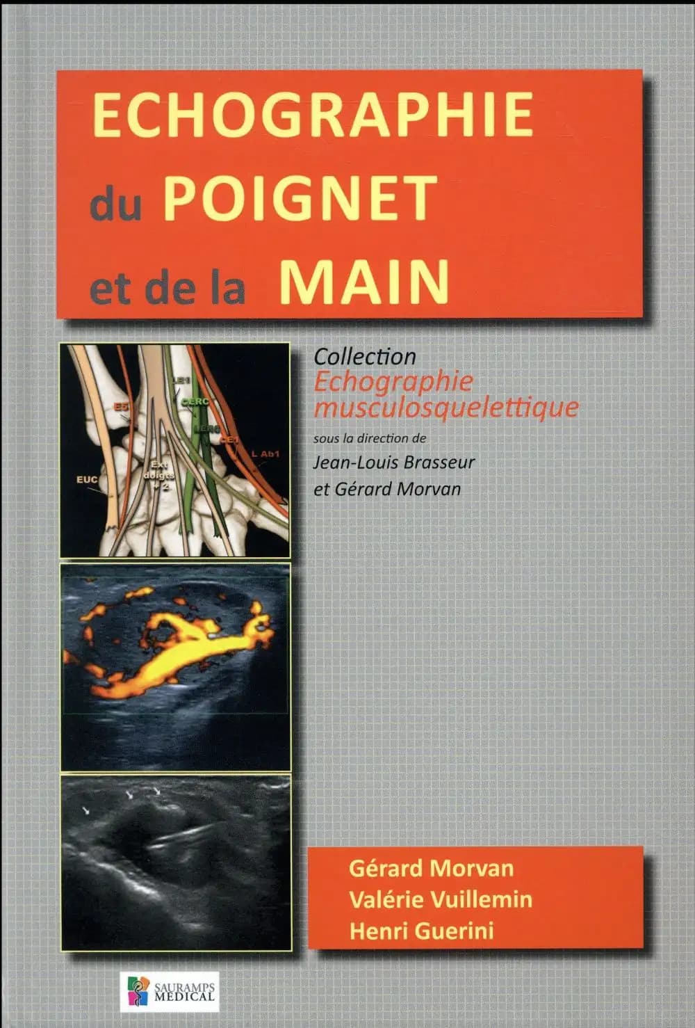 Échographie du poignet et de la main