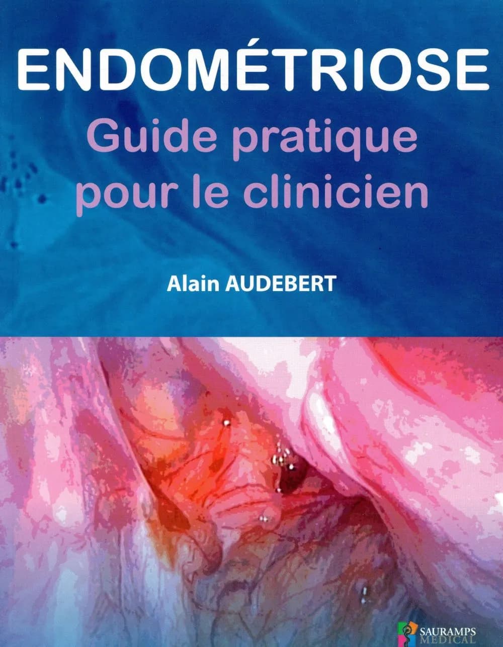 Endométriose : guide pratique pour le clinicien