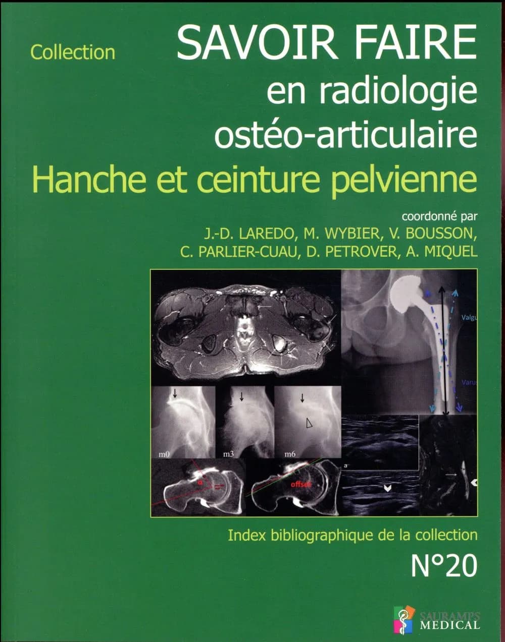 Savoir faire en radiologie ostéo-articulaire. N° 20, Hanche et ceinture pelvienne