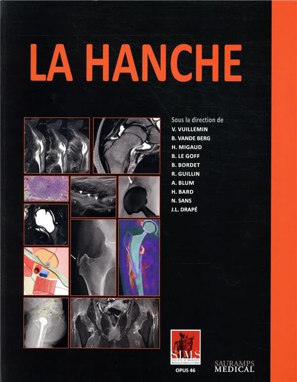 La hanche : la hanche en équilibre, la hanche articulaire, la hanche prothésée, la hanche osseuse, la hache tendineuse
