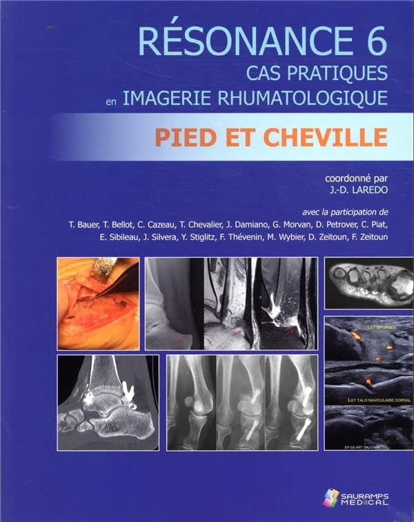 Pied et cheville