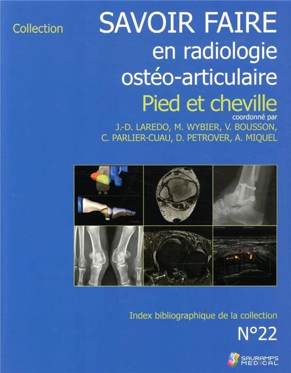 Savoir faire en radiologie ostéo-articulaire. N° 22, Pied et cheville