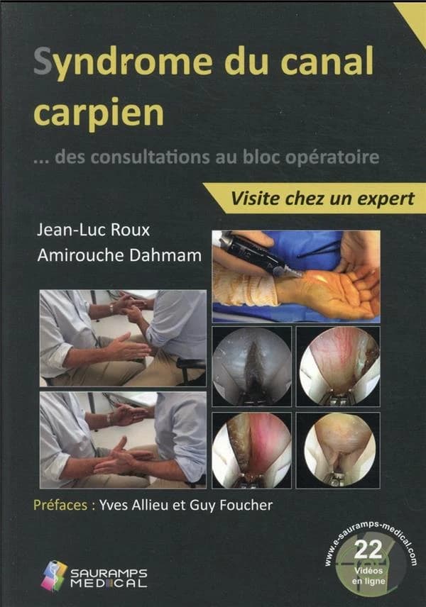 Syndrome du canal carpien : visite chez un expert : des consultations au bloc opératoire