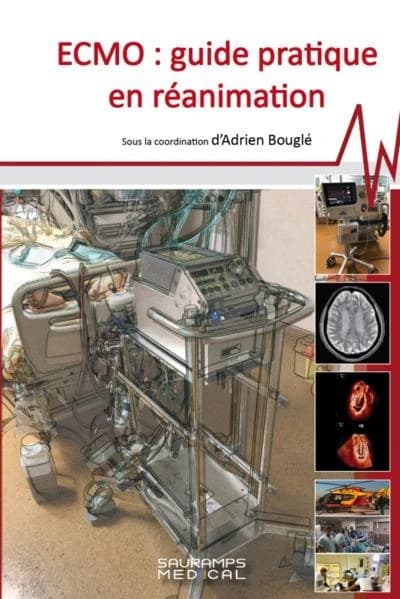ECMO, guide pratique en réanimation