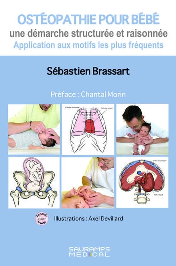 Ostéopathie pour bébé : une démarche structurée et raisonnée : application aux motifs les plus fréquents