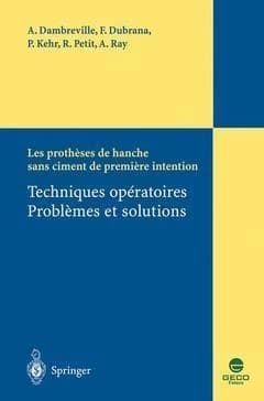 Les prothèses de hanche sans ciment de première intention : techniques opératoires, problèmes et solutions