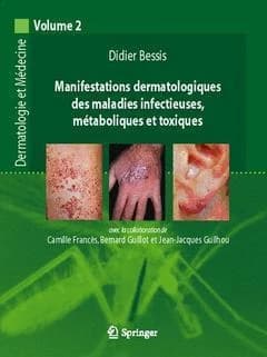 Manifestations dermatologiques des maladies infectieuses, métaboliques et toxiques