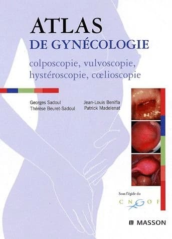 Atlas de gynécologie : colposcopie, vulvoscopie, coelioscopie, hystéroscopie