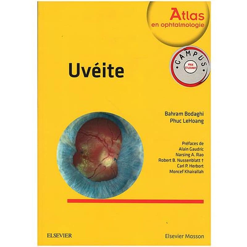 CAMPUS UVEITE