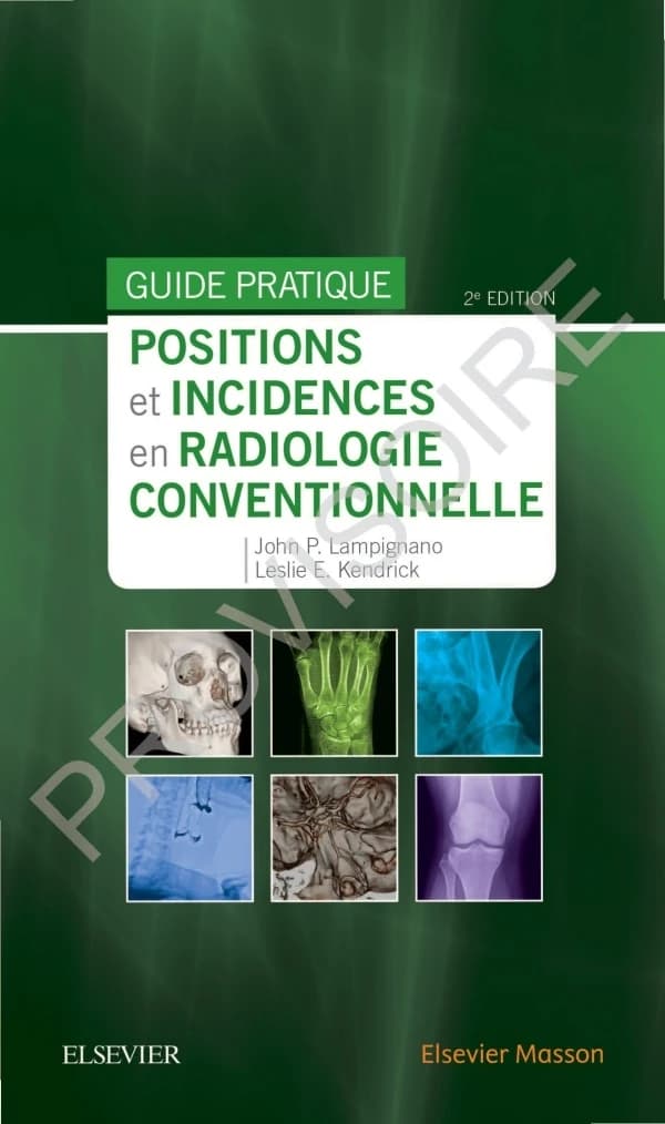 Positions et incidences en radiologie conventionnelle : guide pratique Bontrager (2e éd.) John P. Lampignano,... Leslie E. Kendrick,... ; traduit et adapté de la 9e édition américaine par Eric Bauer et Jean-Philippe Dillenseger,...