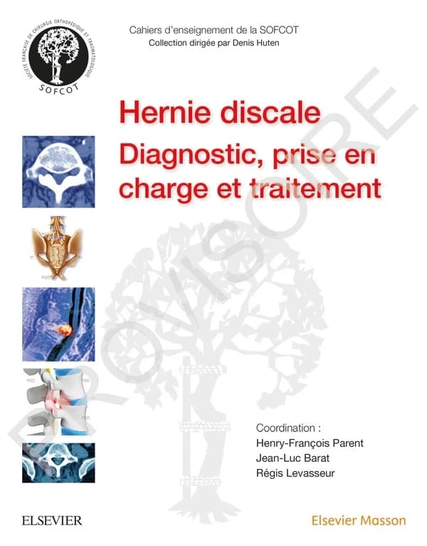 La hernie discale lombaire