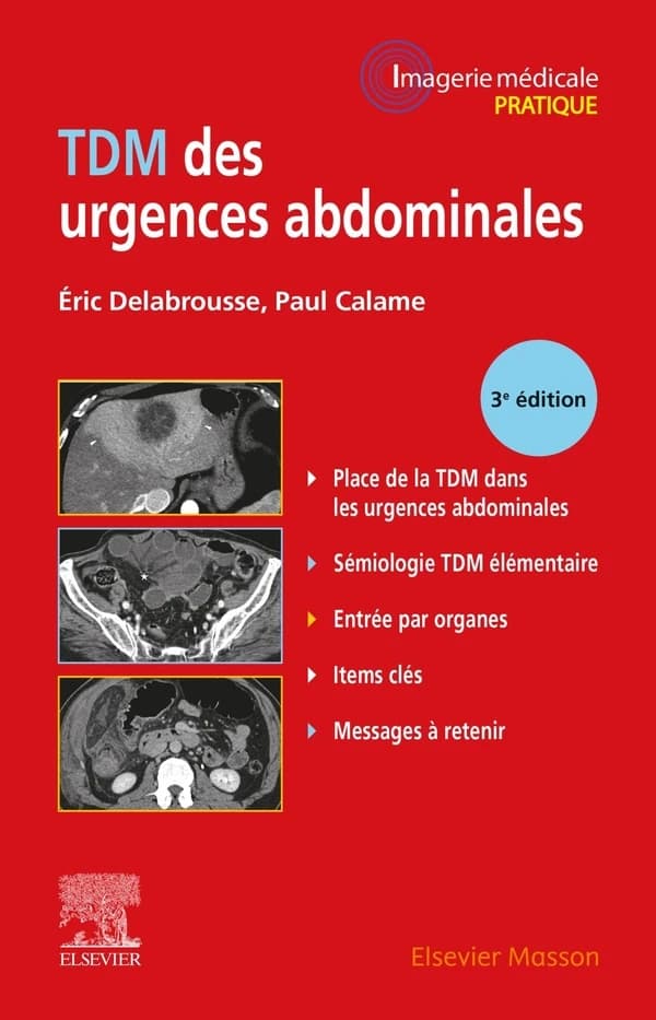TDM des urgences abdominales (3e éd.) E. Delabrousse,... P. Calame,...