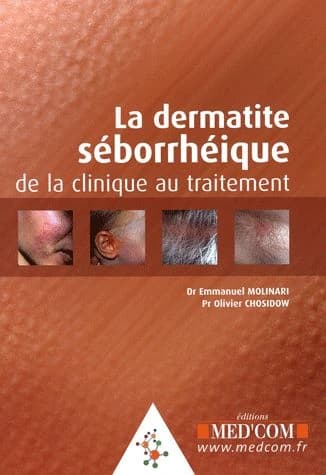 La dermatite séborrhéique : de la clinique au traitement
