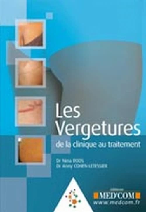 Les vergetures : de la clinique au traitement