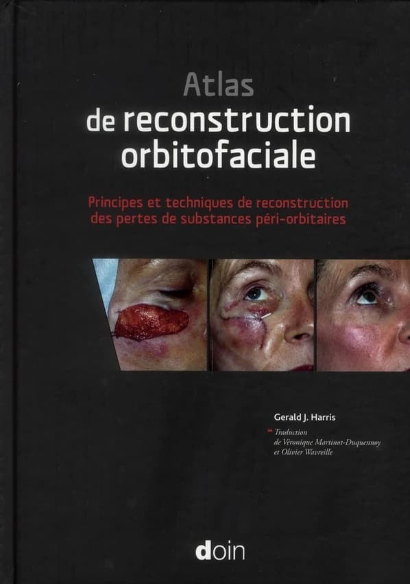 Atlas de reconstruction orbitofaciale : principes et techniques de reconstruction des pertes de substances péri-orbitaires