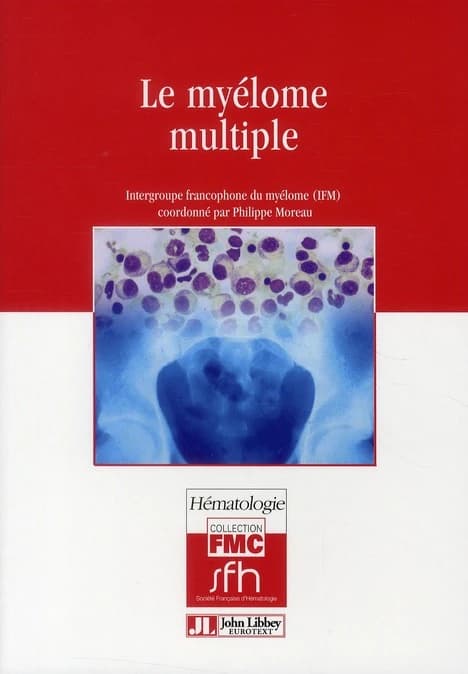 Le myélome multiple