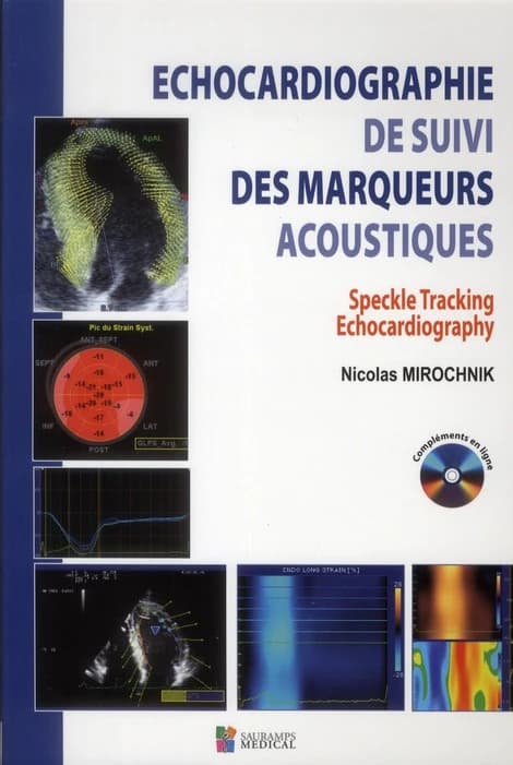 Echocardiographie de suivi des marqueurs acoustiques : mouvement, déplacement-vitesse de déplacement, déformation, strain-strain rate, torsion, rotation-twist : méthodologie, sémiologie