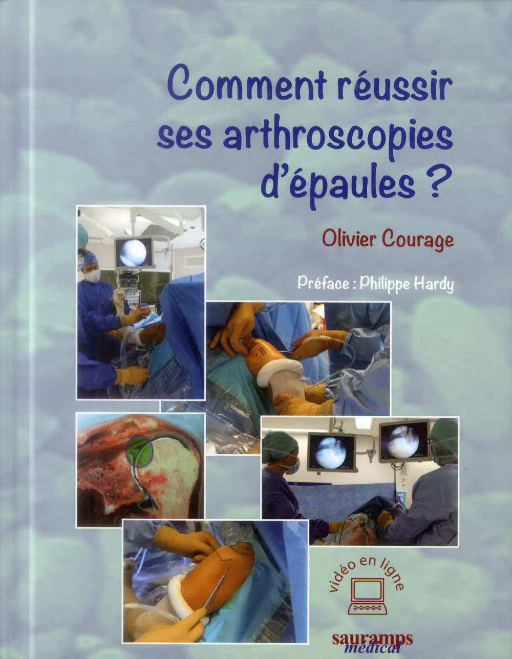 Comment réussir ses arthroscopies d'épaules ?