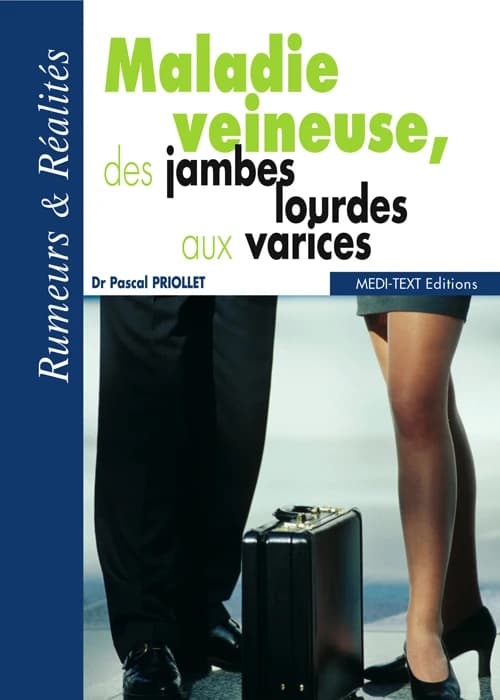 Maladie veineuse : des jambes lourdes aux varices