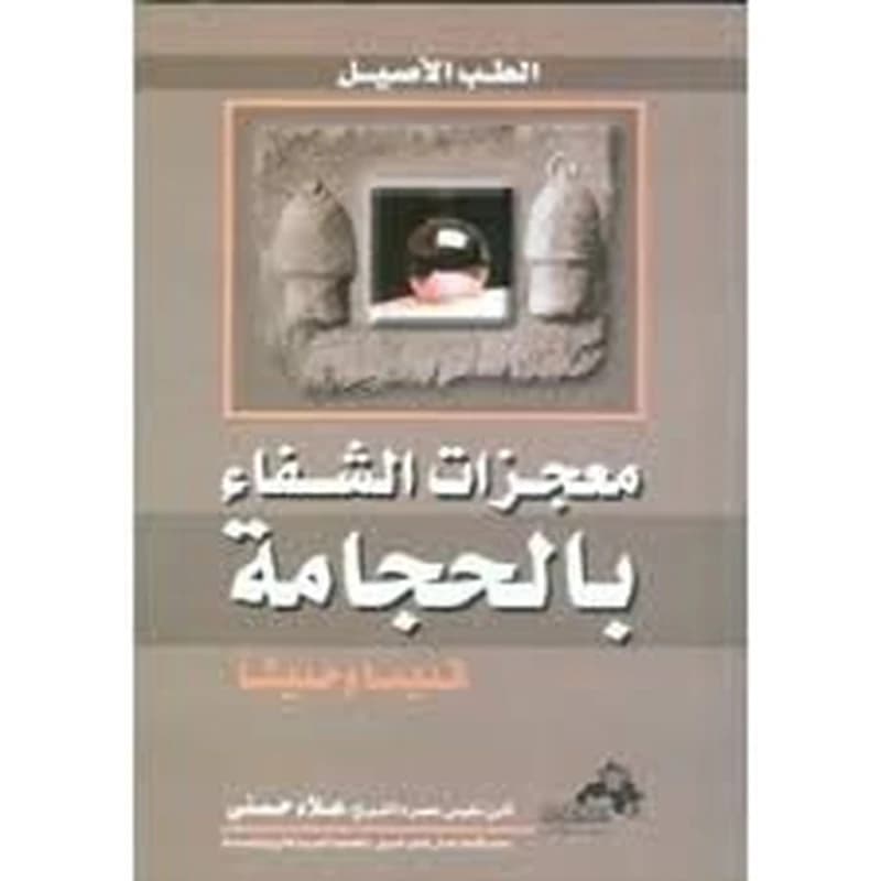 معجزات الشفاء بالحجامة قديما وحديثا